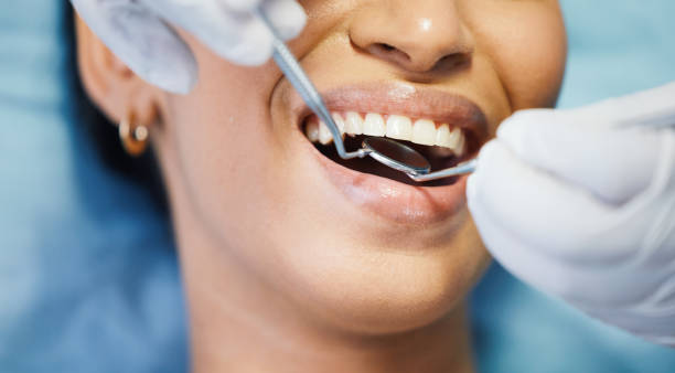 Best Broken or Cracked Tooth Emergency Dentist in Lackawanna, NY
